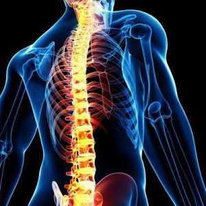 Coloana vertebrală umană: structură. Colonul coloanei vertebrale