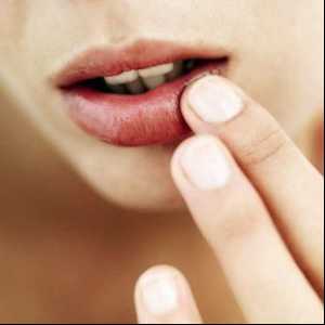 Cauzele și tratamentul fisurilor în colțurile buzelor