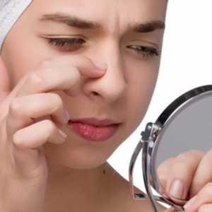Pimple pe nas: un semn pentru bărbați și femei