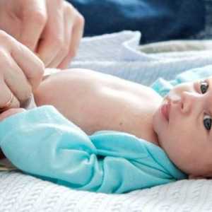 Ombilicul nou-născuților este strâmb, ce ar trebui să fac? Manipulați-vă de buric
