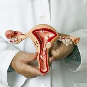 Cancerul uterului: cauze, simptome, tratament. Cancerul uterului: speranța de viață