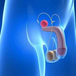 Cancer de prostată de gradul 2: recenzii despre tratament. Simptomele cancerului de prostată la…