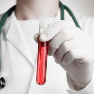 RDW - test de sânge: transcriere, normă