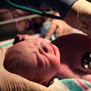 Resuscitarea neonatală: indicații, tipuri, etape, medicamente