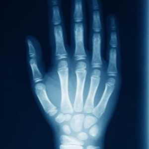 Razele de mână pentru boli și vătămări