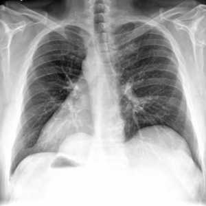 Radiografia este o metodă de studiu a structurii interne a obiectelor care utilizează raze X.…
