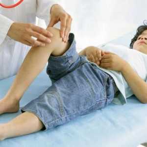Reumatismul la copil: simptome, tratament, prevenire