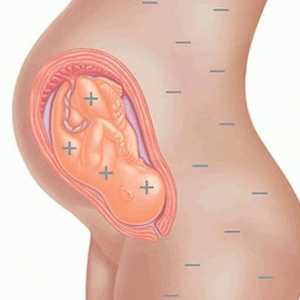 Factorul de rhesus în planificarea sarcinii: recenzii