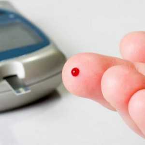 Zahărul 5.5 în sânge - este mult? Norma de zahăr din sânge la o persoană sănătoasă