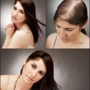 Cel mai bun șampon pentru creșterea părului: evaluare, caracteristici și recenzii