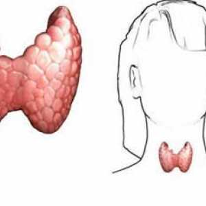 Glanda tiroidă a crescut: simptome. Primele simptome ale bolii tiroidiene