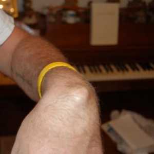 Conuri de mâna pe încheietura mâinii sau hygroma: simptome, cauze și metode de tratament