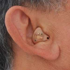 Ajutor pentru audiere în ureche: avantaje și particularități de utilizare