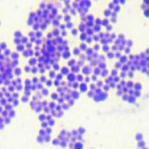 Staphylococcus un copil: simptome și tratament