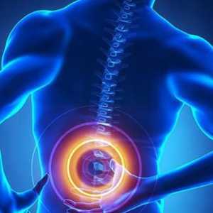 Stenoza coloanei vertebrale lombare: cauze și tratament