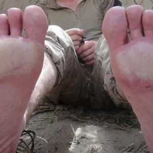 Sifon picior - boala neplăcută a picioarelor umede și înghețate