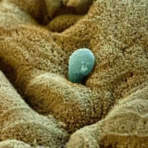 Structura și ciclul de viață al dizenteriei amoeba