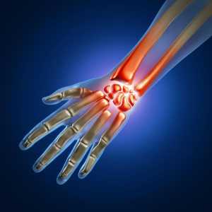 Tendovaginita articulației încheieturilor mâinii: tratament, cauze