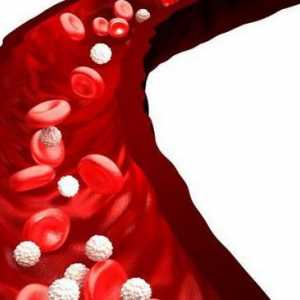 Tipuri de sângerare: cauze, simptome și tratament. Tipuri de sângerare în Barkagan