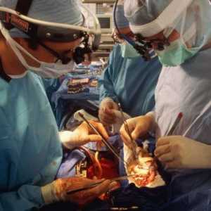 Transplantul de organe și țesuturi. Transplantul de organe în Rusia