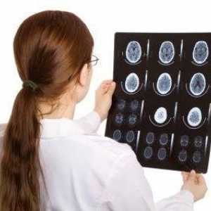 Tremor al capului: cauze și simptome. Care este tremorul capului și cum să scapi de el?