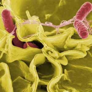 Enterobacterii patogene convențional - ce este? Boli cauzate de enterobacterii