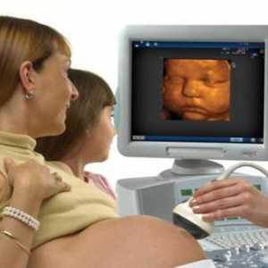 US de 3D în timpul sarcinii