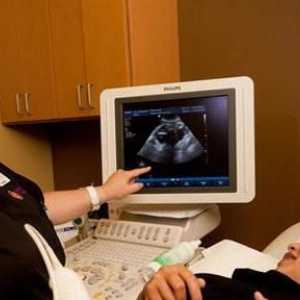 Screening-ul cu ultrasunete de 1 trimestru: interpretarea rezultatelor. Cum se efectuează…