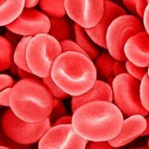 Sunteți îngrijorat de sângele dens: cauzele și tratamentul