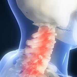 Cervicalgia vertebrogenă: cauze, simptome și metode de tratament