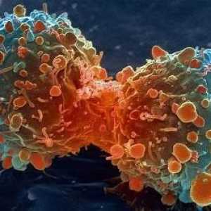 Tipuri de cancer și metode de tratament. Cea mai periculoasă formă de cancer