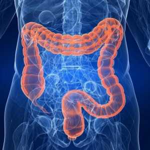 Colonoscopia virtuală a intestinului: recenzii și descrierea procedurii