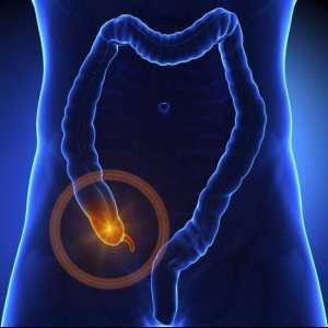 Inflamația apendicitei: o descriere, simptome, cauze și caracteristici ale tratamentului