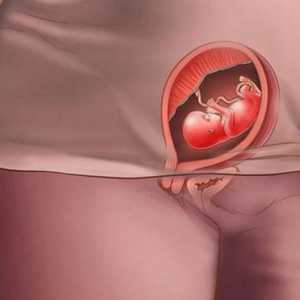 Izolarea galben-verde în timpul sarcinii în perioadele timpurii fără miros - este periculos sau nu?