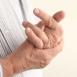 Dislocarea degetului în mână: descrierea și caracteristicile tratamentului