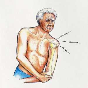 Dislocarea articulației umărului: tratament la domiciliu. Dislocarea articulației umărului: cauze
