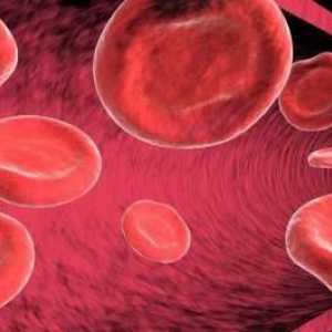 Boala anemiei - ce este?