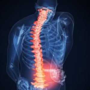 Probleme ale terapiei de exerciții la osteocondroza coloanei vertebrale lombare