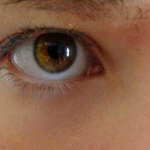 Galben sub ochi: cauzele și caracteristicile tratamentului