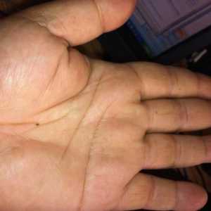 Semnificația moliilor din palma mâinii tale: ce spune palmistry?