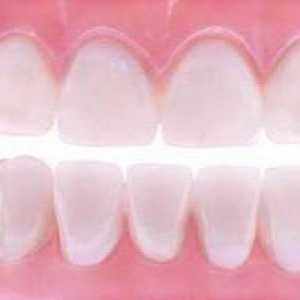 Protezele dentare moi: recenzii de experți, fotografii